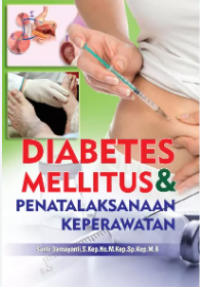 Image of Diabetes Meliitus dan Penatalaksaan Keperawatan